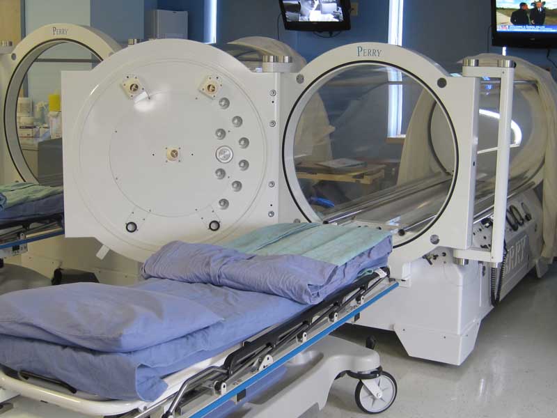 Hyperbaric Oxygen Chambers
