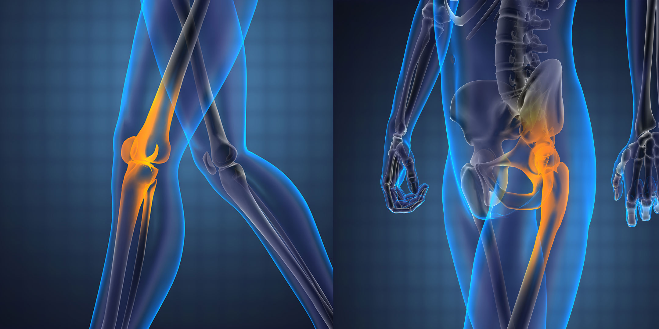 Side-by-side anatomical images of an inflamed knee and an inflamed hip